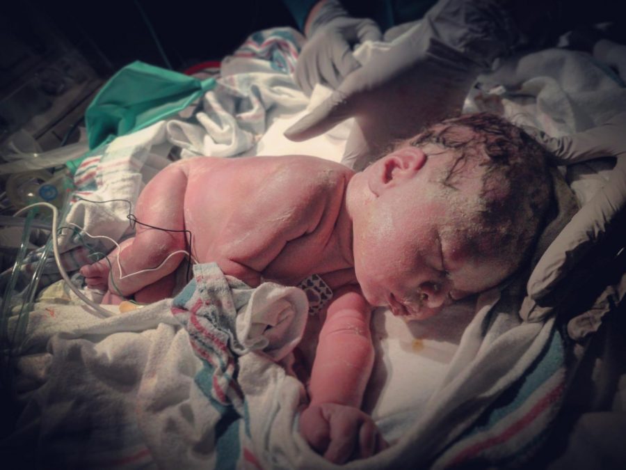Newborn Emilia Emmie Boylan at the University of Iowa Childrens Hospital right after her birth.